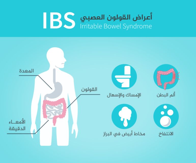 أعراض القولون العصبي